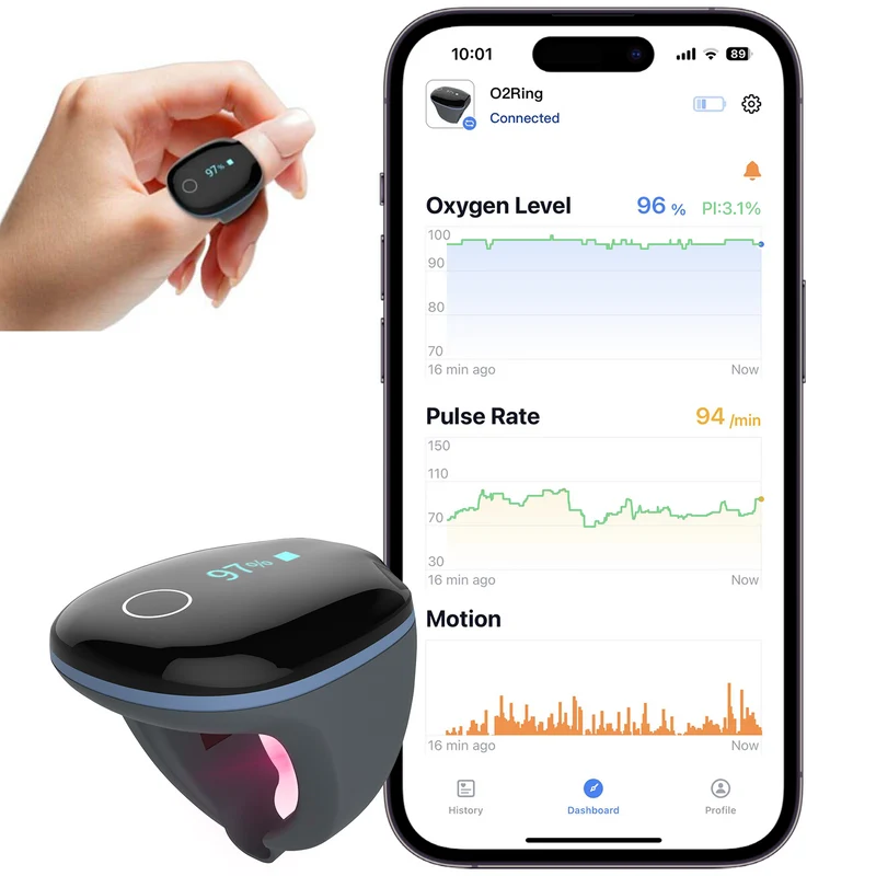 Monitoraggio continuo dell'ossigeno ad anello O2Ring™
